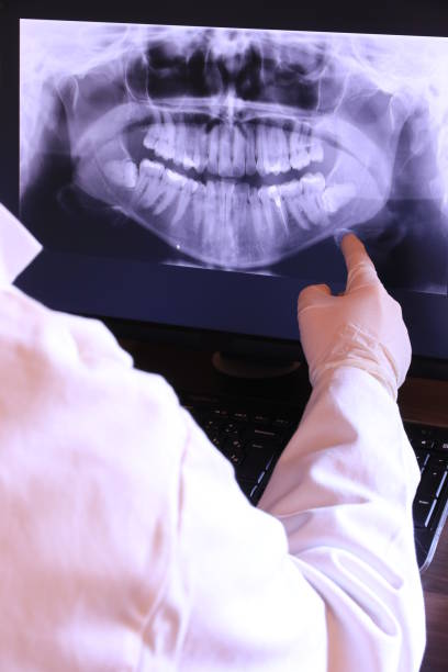 Best Emergency Treatment for Oral Infections in Cincinnati, OH