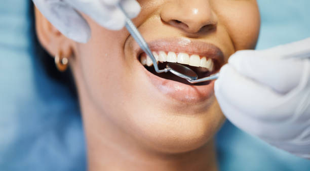 Best Walk-In Emergency Dental Services in Cincinnati, OH