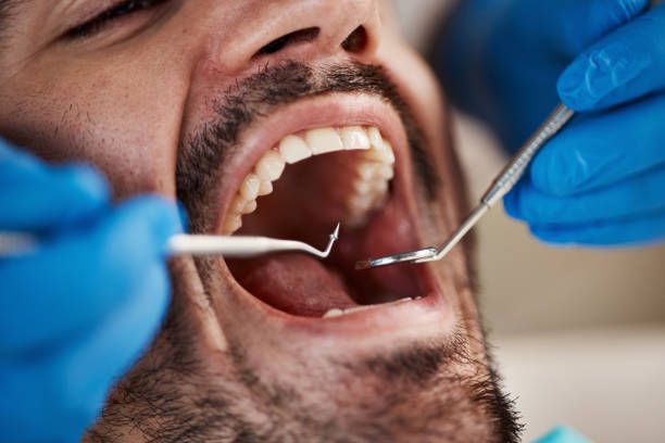 Best Broken or Chipped Tooth Repair in Cincinnati, OH