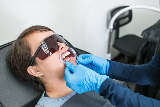 Best Emergency Wisdom Tooth Extraction in Cincinnati, OH